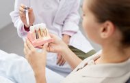 Cum se plasează un implant dentar?