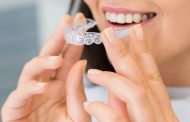 Ce este Invisalign și cine poate beneficia de tratament cu acest aparat dentar