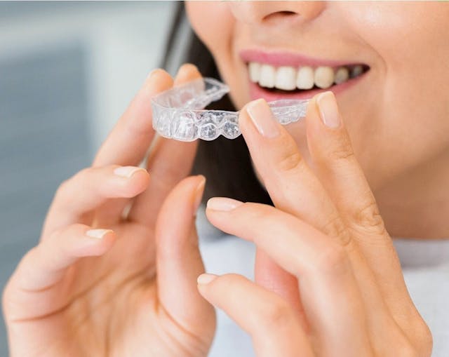 Ce este Invisalign și cine poate beneficia de tratament cu acest aparat dentar