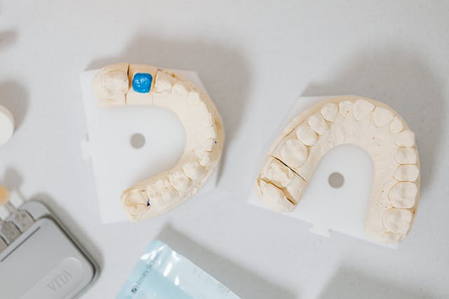 Cum știi că ai nevoie de o coroană dentară