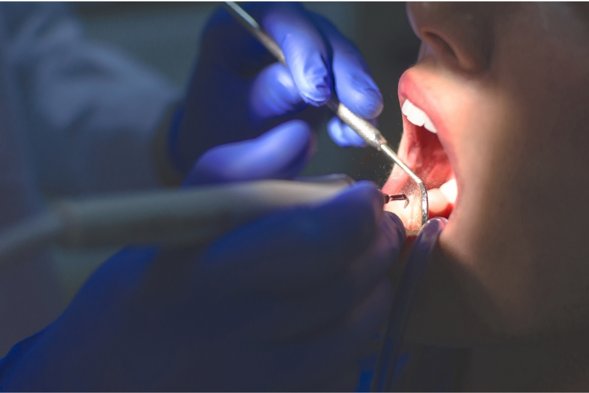 Microscopul endo – ce tehnologii are la bază și cum influențează tratamentul?